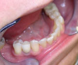 Close-up of patients' teeth
