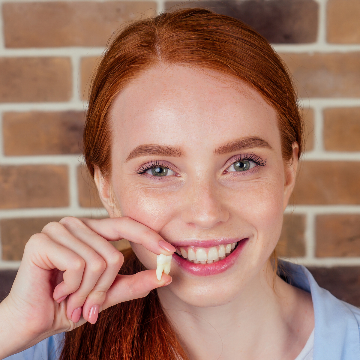 tooth-extraction-by-dr-galperin-alpharetta-roswell-ga